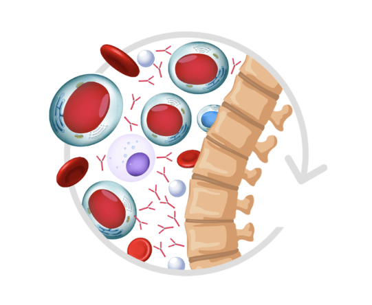 An example of a cell with relapsed/refractory multiple myeloma